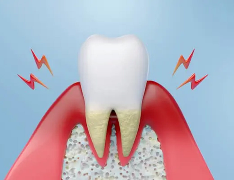 江北、豊島、東十条の歯科医院グループ、医療法人社団 医智会 医恵歯科医院の、歯ぎしり、食いしばり