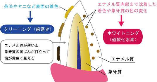 江北、豊島、東十条の歯科医院グループ、医療法人社団 医智会 医恵歯科医院の、ホワイトニング